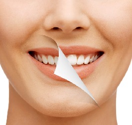 Tooth Whitening