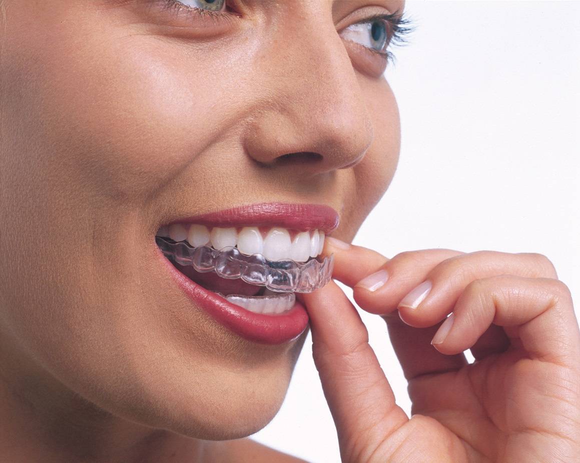 Invisible Orthodontics – Clear Path