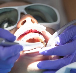 LANAP Dental Treatment