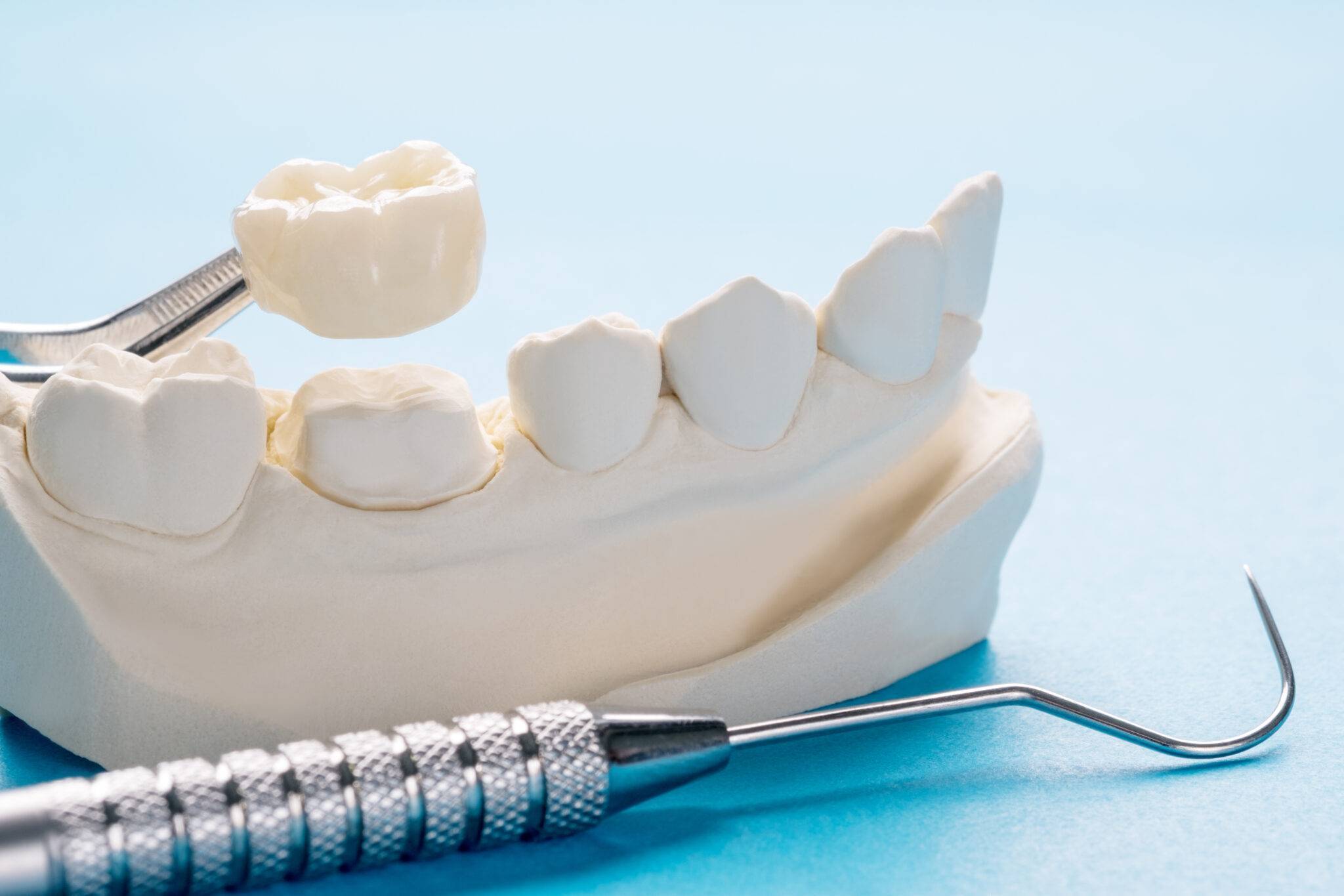 Dental Crown