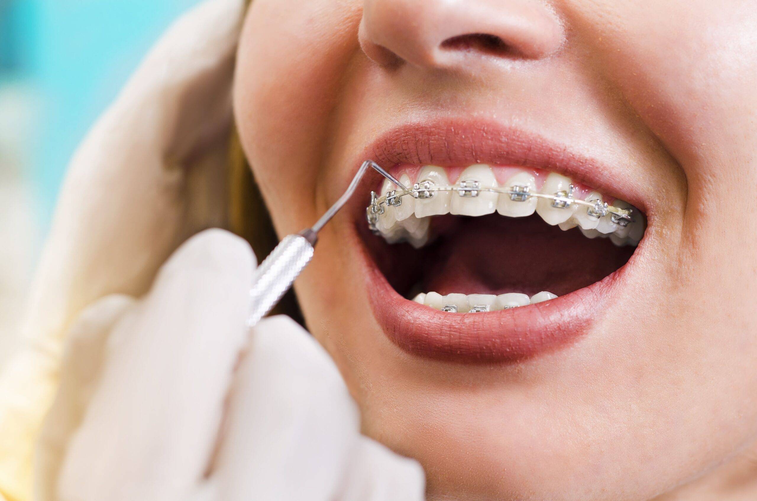 Laser Assisted Treatments