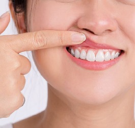 Crown Lengthening Bangalore