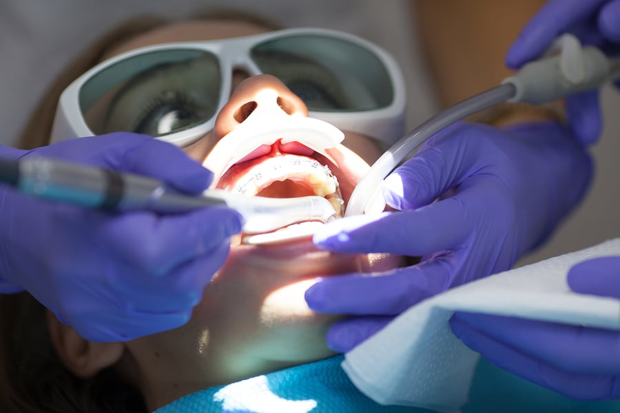 Root Canal Treatment