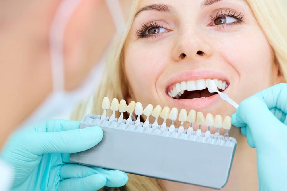 Dental Veneers Bangalore