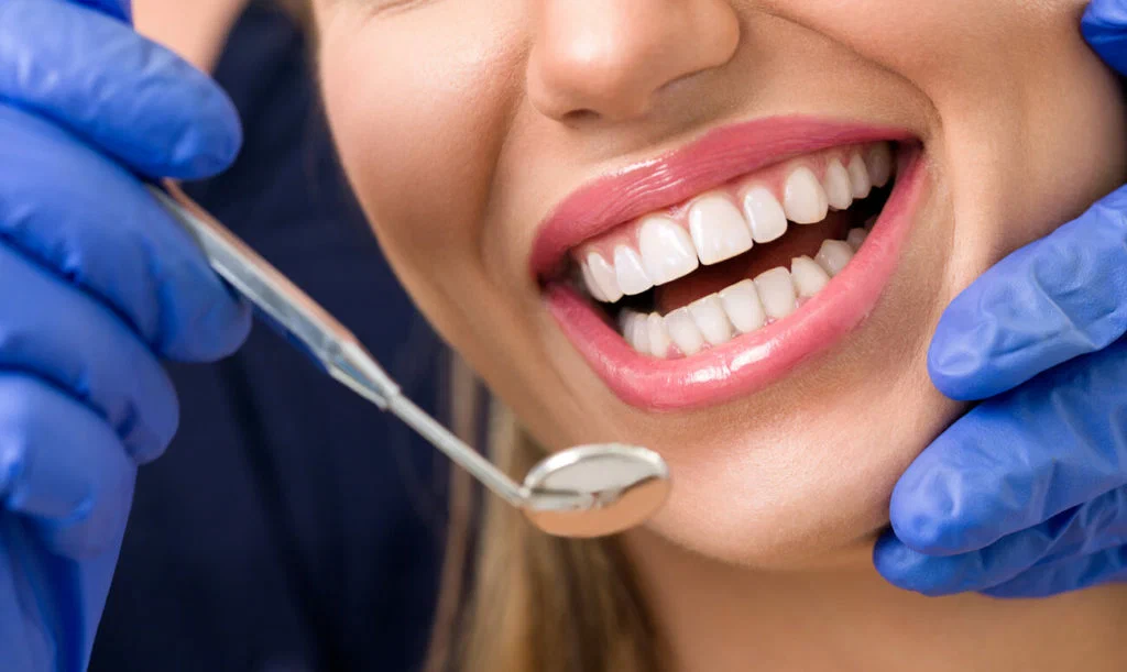 Dental Crowns Bangalore