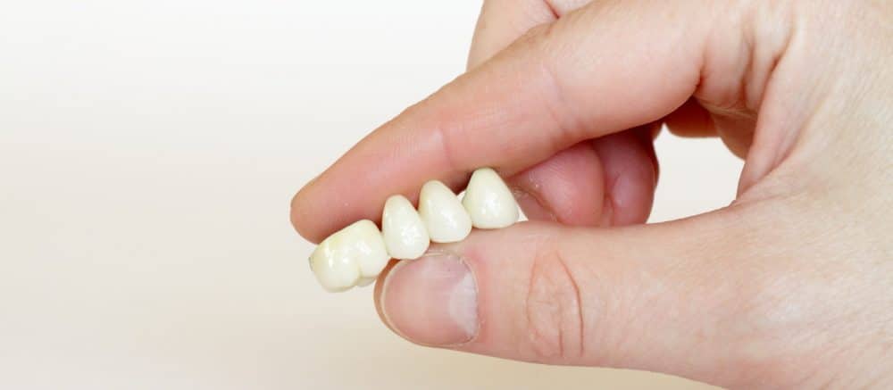 Clear Dental Aligners Bangalore