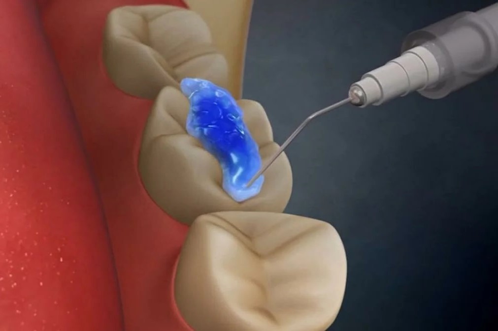 General Dentistry in Bangalore