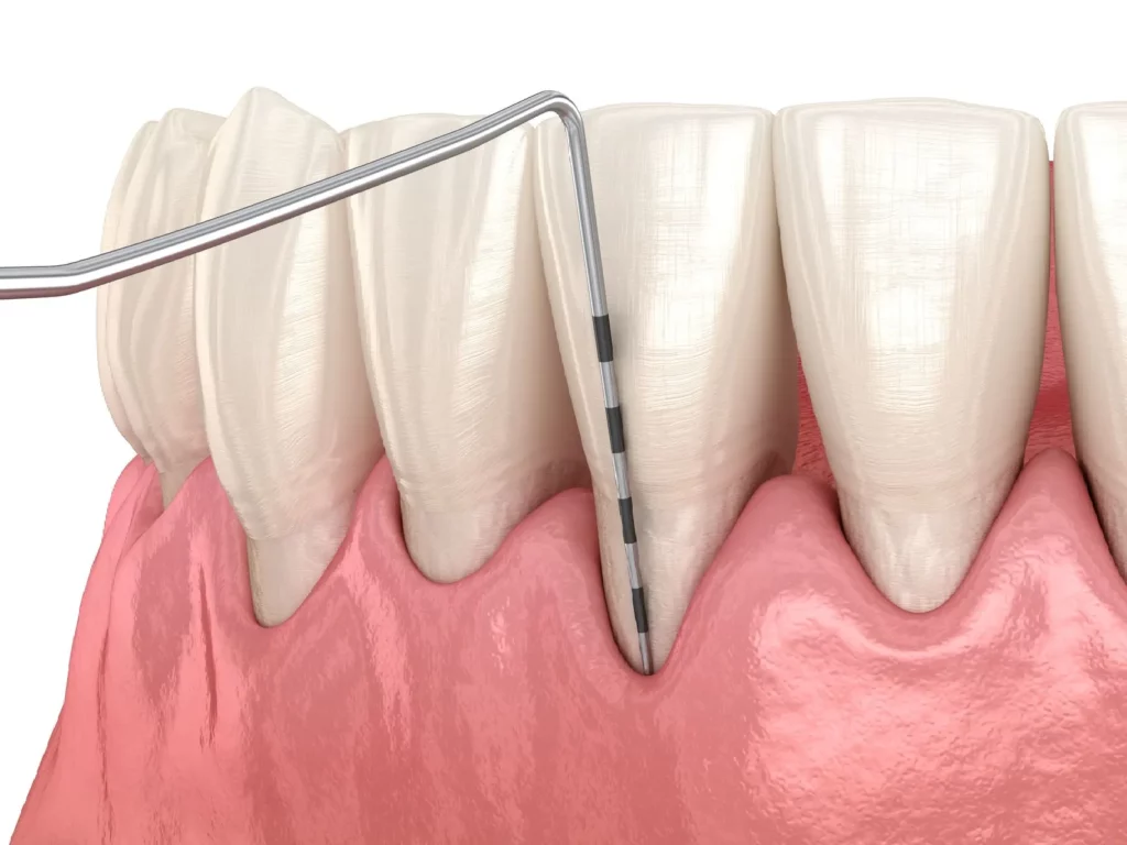 Best Periodontist in Bangalore