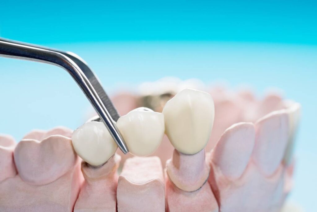 Best Prosthodontist in Bangalore​