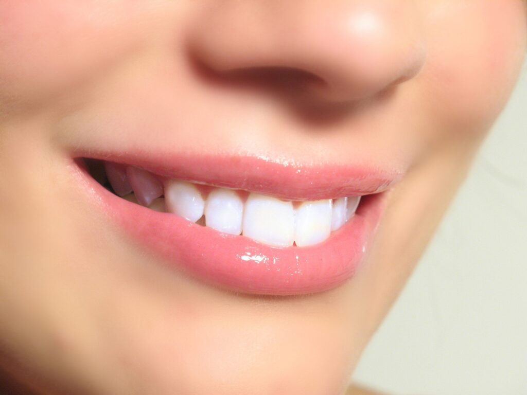 Smile Makeover Bangalore