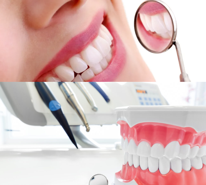 Intra Oral Photography Dental Services