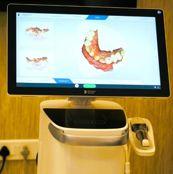 DENTSPLY_PRIMESCAN_CART-VERSION