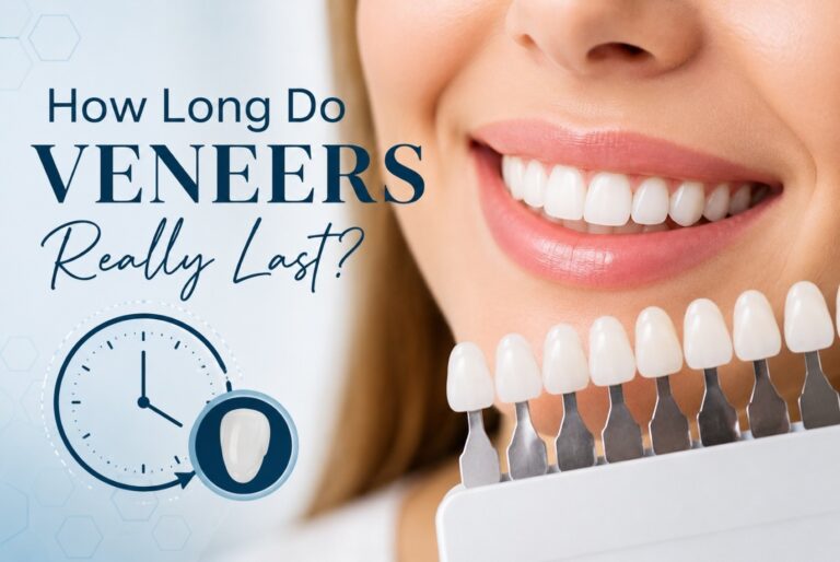 A close-up of a woman smiling with white teeth while a dentist holds up a porcelain veneer shade guide, featuring text that asks 'How Long Do VENEERS Really Last?' next to a clock icon.